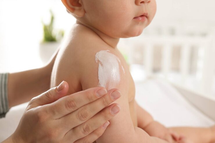 applying ointment on a child